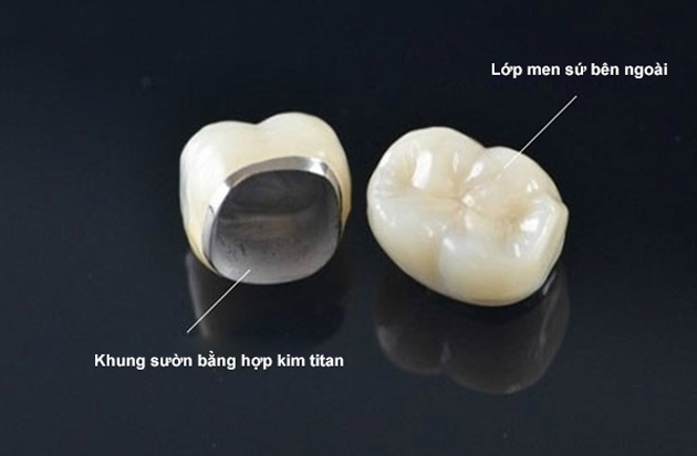 RĂNG SỨ TITAN