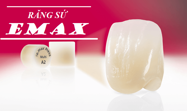 RĂNG SỨ EMAX